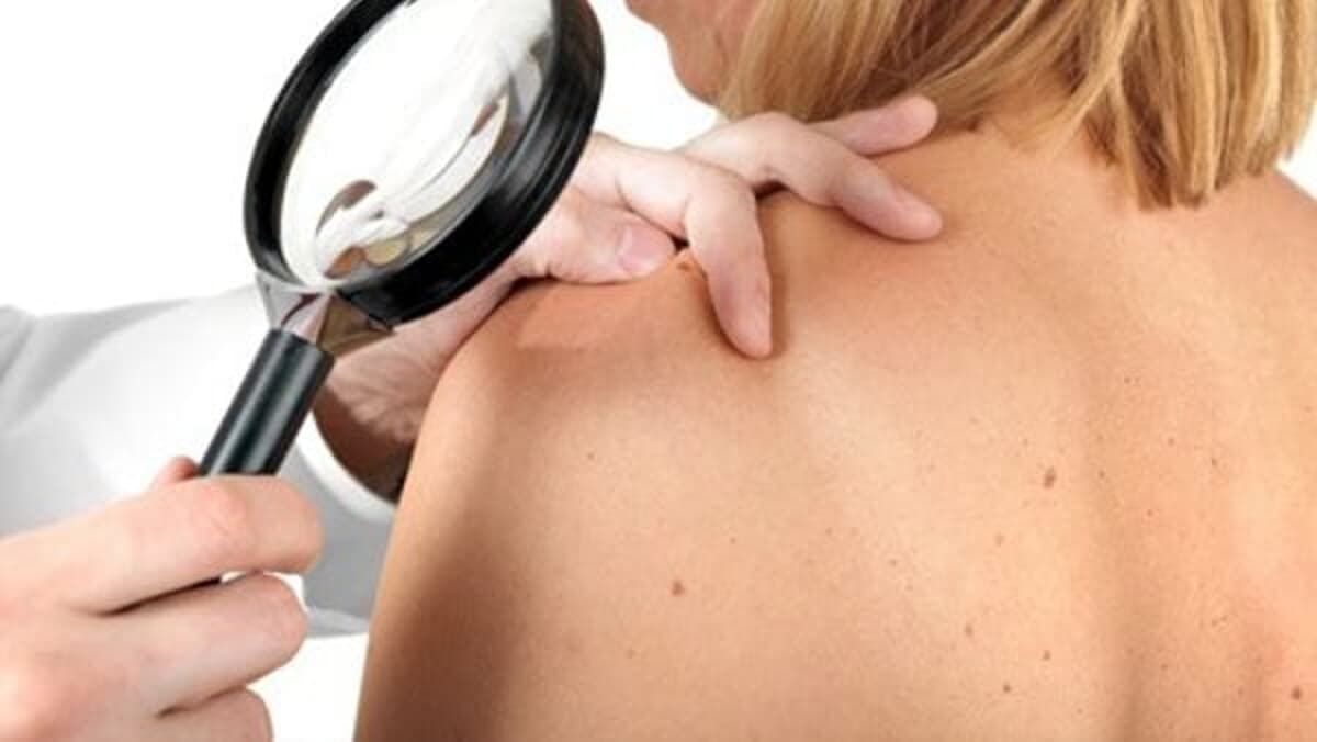 "Il sole per amico": il liceo scientifico conquista l'Italia con la sua lezione di prevenzione